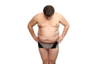 STUDIU In Romania, obezitatea afecteaza mai des barbatii decat femeile