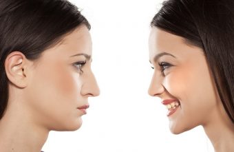 Cum te poate ajuta rinoplastia sa-ti imbunatatesti respiratia