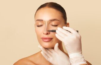 Rinoplastie: 7 beneficii importante