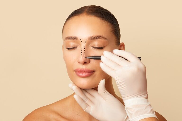 Rinoplastie: 7 beneficii importante