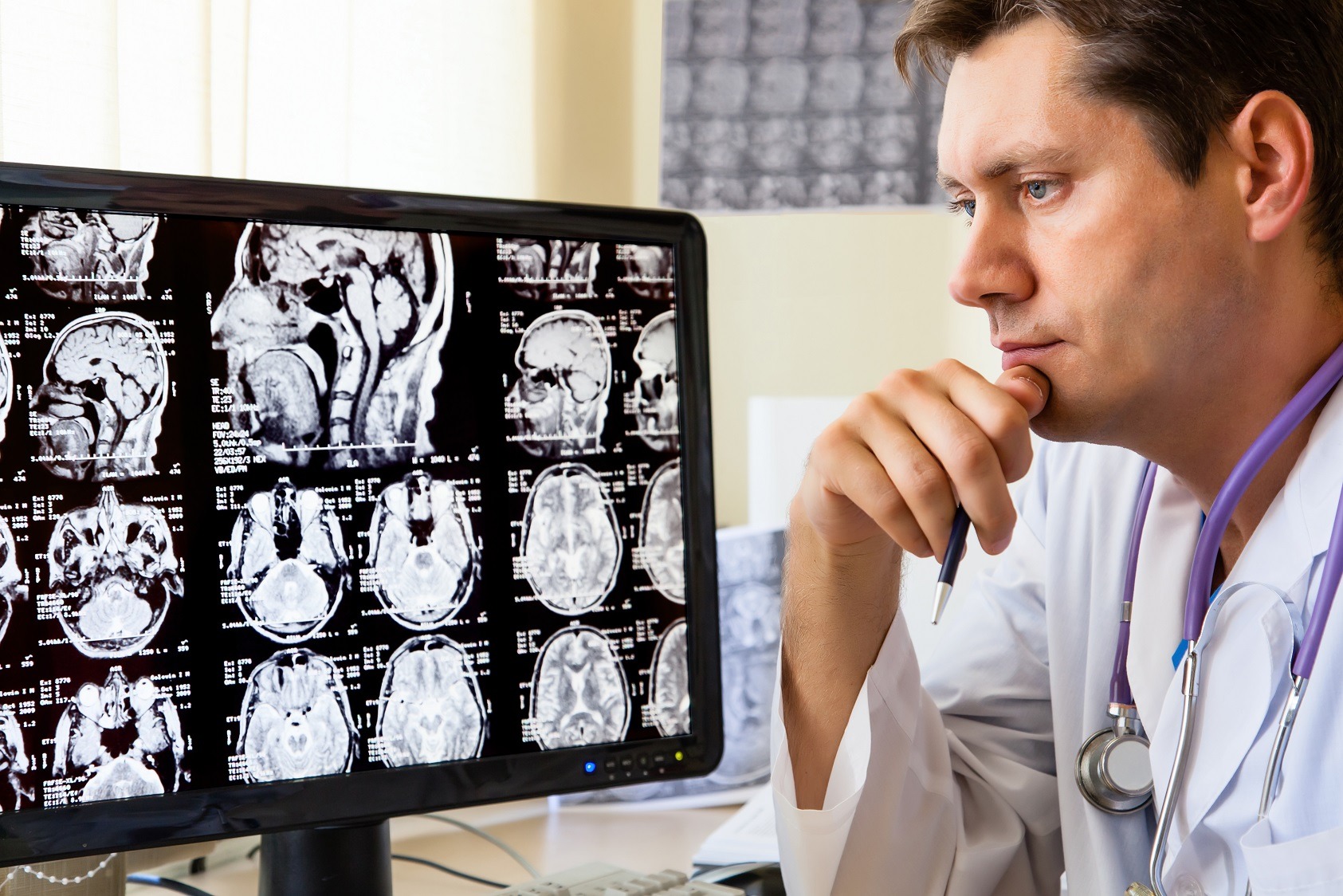 Medic neurolog: „Peste 50% dintre pacientii cu accident vascular cerebral au exces ponderal”