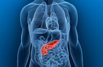 Medic gastroenterolog: „Pancreatita acuta este o urgenta majora, amenintatoare de viata!”