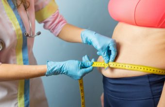 Abdominoplastia: ce e important de știut