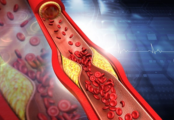 Slăbirea sănătoasă și managementul colesterolului