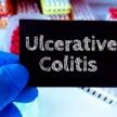 Colita ulcerativă – semne, simptome și tratament