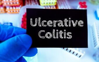 Colita ulcerativă – semne, simptome și tratament