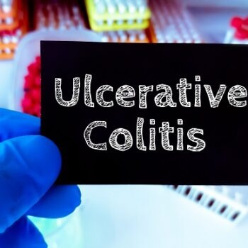Colita ulcerativă – semne, simptome și tratament