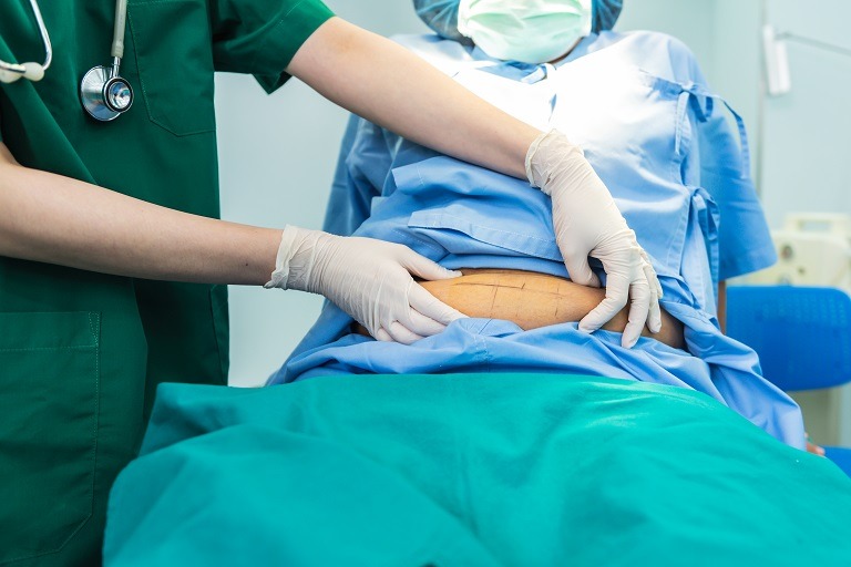 Chirurgia obezității, eficientă pentru controlul pe termen lung al tensiunii arteriale