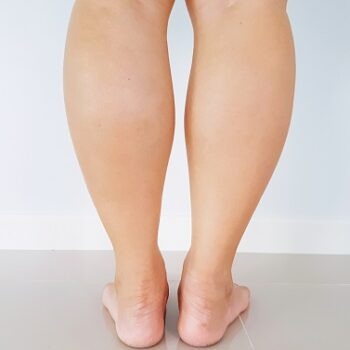 Exerciții fizice recomandate persoanelor cu gambe groase