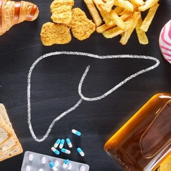 Ficat gras: cauze, simptome și tratamente eficiente