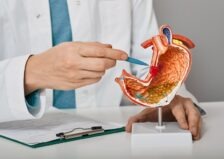 Cancerul de stomac – simptome și semne