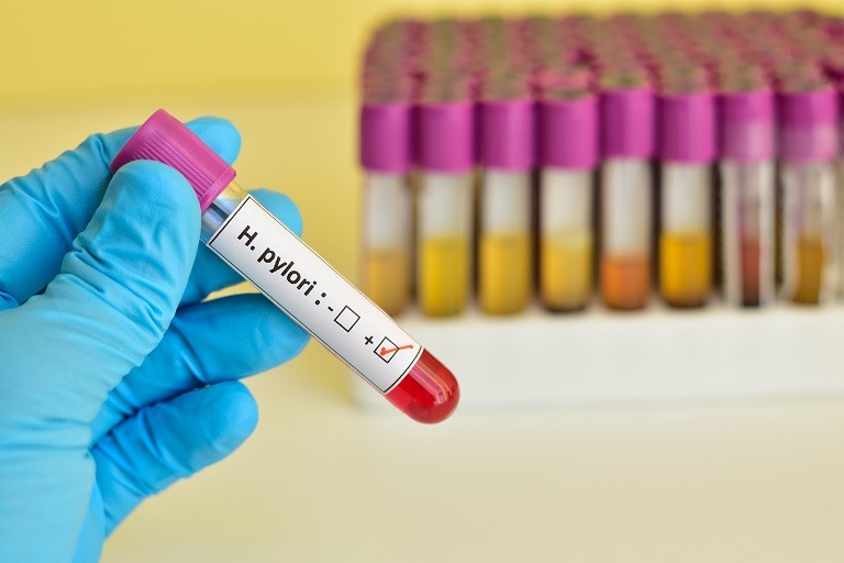 Helicobacter pylori, de la simptome la diagnostic și tratament