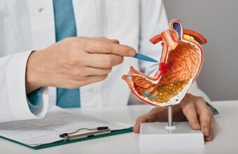Fiți atenți la simptomele subtile ale ulcerului gastric ca să evitați complicațiile