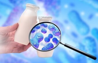 Probiotice naturale – care sunt alimentele care conțin probiotice?