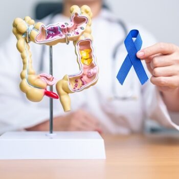 cancerul colorectal este o problemă de sănătate publică