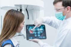 radiografie dentara