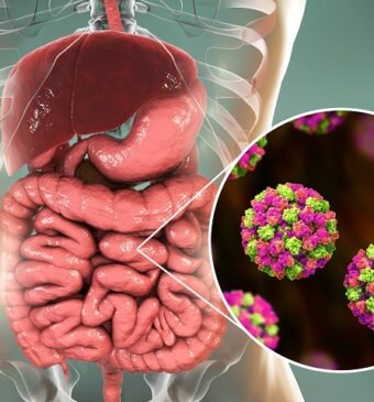 Astrovirus copii și adulți: simptome, complicații, prevenție