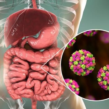 Astrovirus copii și adulți: simptome, complicații, prevenție