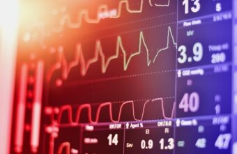 măsurători ale ritmului cardiac