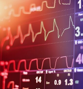 măsurători ale ritmului cardiac