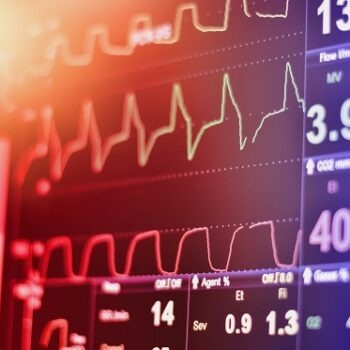 măsurători ale ritmului cardiac