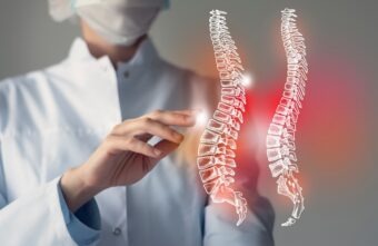 Cele mai bune exerciții recomandate în cifoză