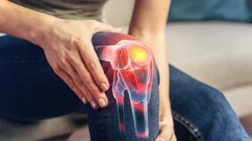 Colagen – 7 beneficii pentru sănătatea articulațiilor și mobilitate