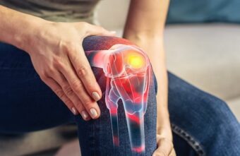 Colagen – 7 beneficii pentru sănătatea articulațiilor și mobilitate