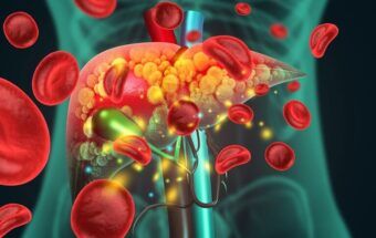 Legătura dintre consumul zilnic de fructe și ficatul gras