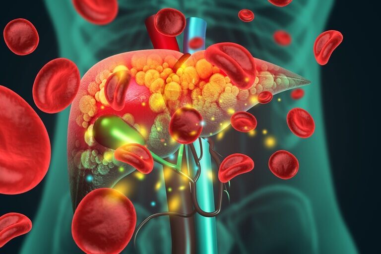 Legătura dintre consumul zilnic de fructe și ficatul gras
