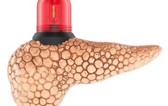 Pancreas gras: cauze, factori de risc, alimente recomandate