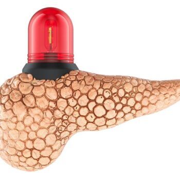 Pancreas gras: cauze, factori de risc, alimente recomandate