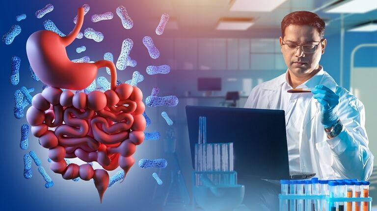 Antrenamentele intense îți pot „reconfigura” bacteriile intestinale