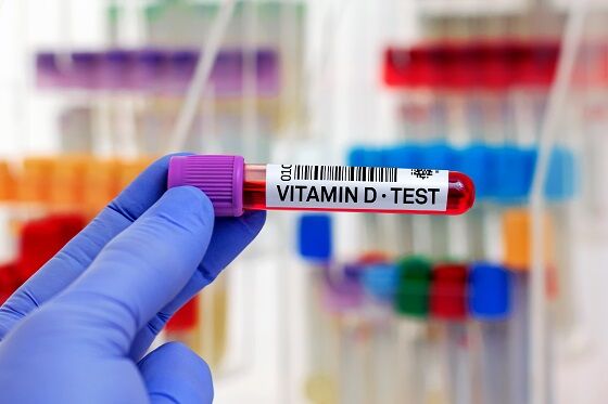 test de sânge vitamina D