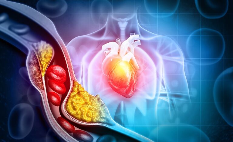 Dislipidemie: ce este, ce rol joacă alimentația și ce soluții există