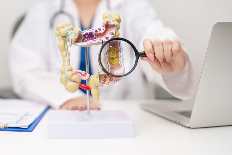 Lista completă de alimente interzise în sindromul de colon iritabil