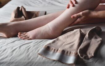 De ce te confrunți cu picioare umflate de la căldură și cum poți preveni acest simptom?