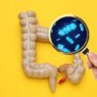 Disbioza intestinală: ce este, ce cauze are, cum se manifestă, care este alimentația corectă
