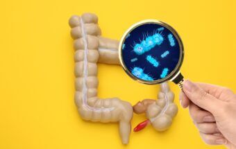 Disbioza intestinală: ce este, ce cauze are, cum se manifestă, care este alimentația corectă
