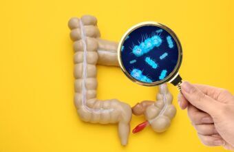 Disbioza intestinală: ce este, ce cauze are, cum se manifestă, care este alimentația corectă