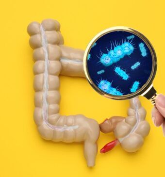 Disbioza intestinală: ce este, ce cauze are, cum se manifestă, care este alimentația corectă