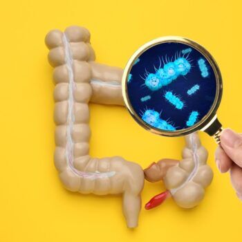 Disbioza intestinală: ce este, ce cauze are, cum se manifestă, care este alimentația corectă