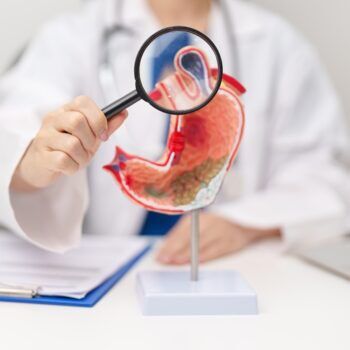 Ulcer duodenal: ce este, simptome, cauze, tratament și regim alimentar