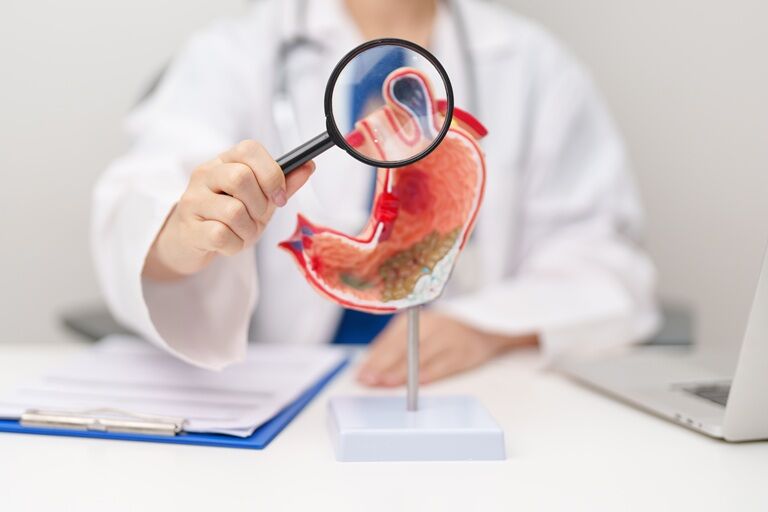 Ulcer duodenal: ce este, simptome, cauze, tratament și regim alimentar