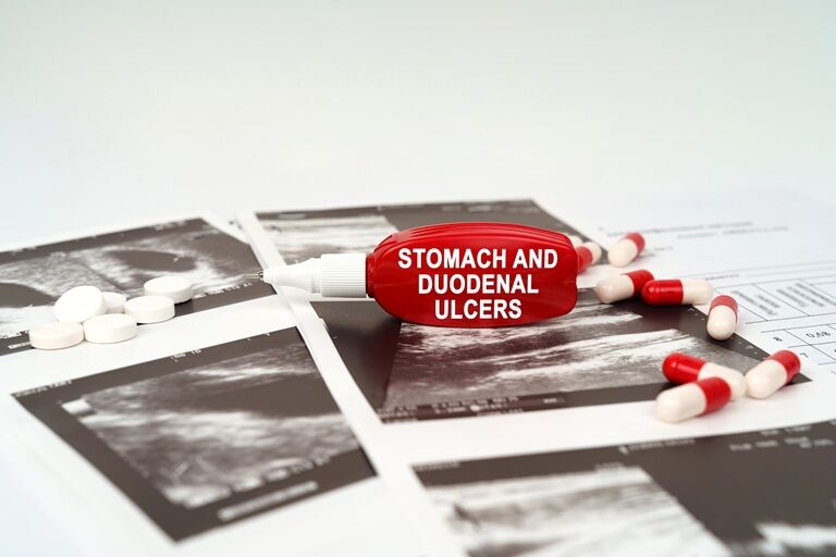 Ulcer duodenal: ce este, simptome, cauze, tratament și regim alimentar