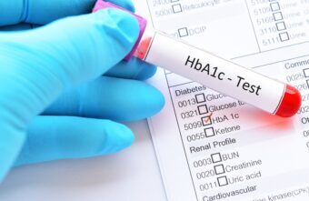 Hemoglobina glicată (Hb A1c): valori, interpretare și ce indică rezultatul