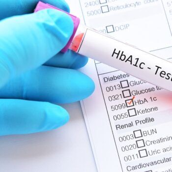 Hemoglobina glicată (Hb A1c): valori, interpretare și ce indică rezultatul