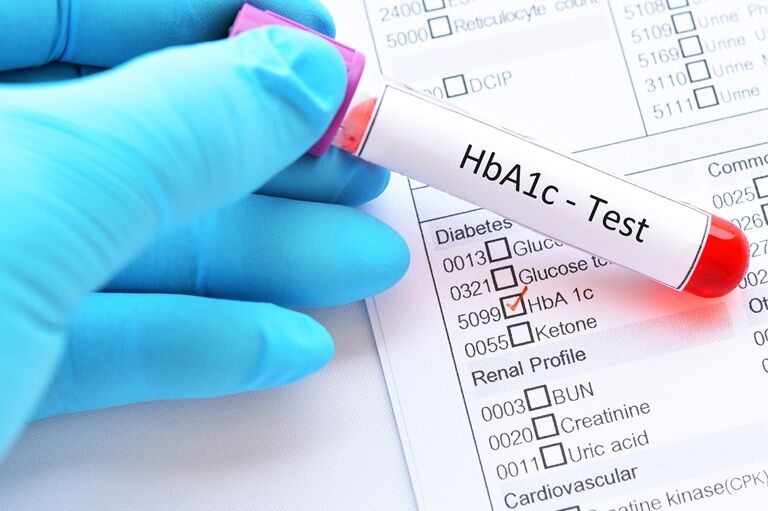 Hemoglobina glicată (Hb A1c): valori, interpretare și ce indică rezultatul